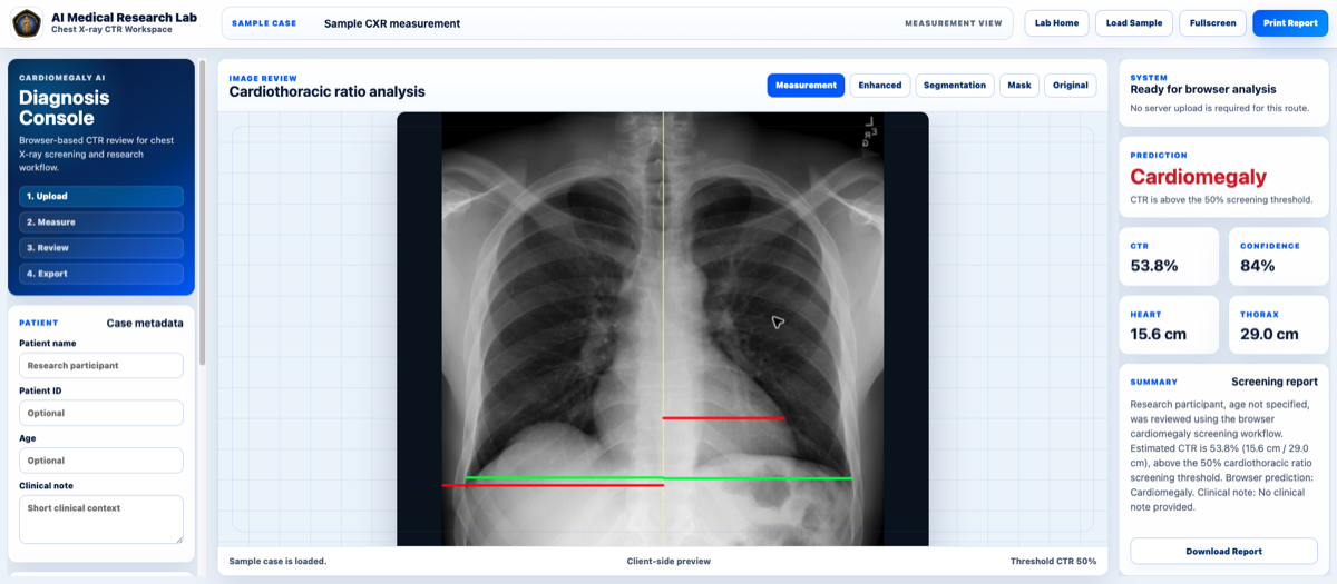 Cardiomegaly diagnosis browser workspace preview