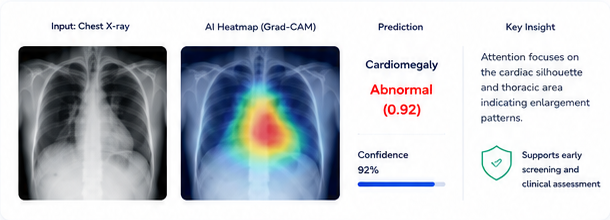 Chest X-ray and AI heatmap example